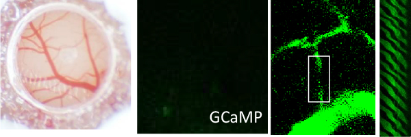 Two-photon Imaging of cerebral neurons and vasculature